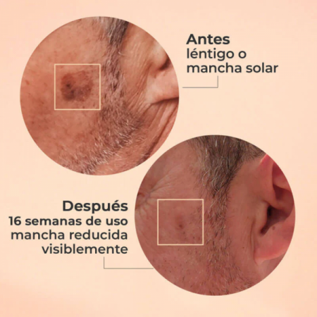 SEGLE SERUM GLICOLMIX EXFOLIANTE 30ML