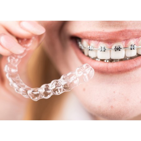 LACER ALIGNER ORTODONCIA PASTA DENTIFRICA SABOR MENTA 125 ML