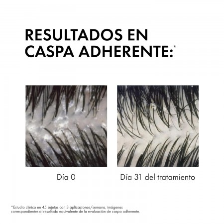 DERCOS TECHNIQUE CHAMPU ANTICASPA CABELLO GRASO 390 ML