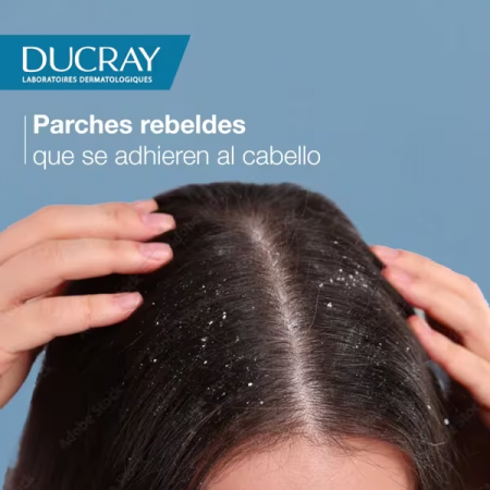 DUCRAY KELUAL DS CHAMPU TRATANTE 100 ML