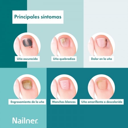 PACK NAILNER PINCEL ANTIHONGOS DE UÑAS 2EN1 5ML + REGALO NAILNER ULTIMATE FORTALECEDOR 10ML