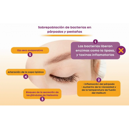 OCUDOX BLEFARITIS SOLUCION SPRAY 60 ML
