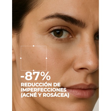SEGLE KIT ACNE-ROSACEA: SERUM EXFOLIANTE AHA/BHA 30ML + GEL-CREMA CLEAR AZELAIC 30ML