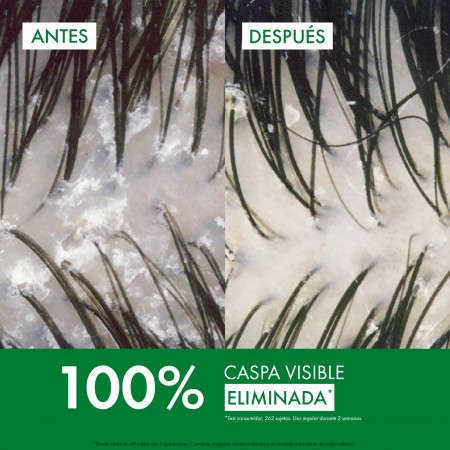 Eficacia del champú anticaspa formato viaje con 100% de eliminación de caspa visible Vichy Dercos