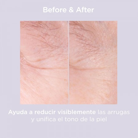 ISDINCEUTICS GLICOISDIN 15 MODERATE 15% A.GLICOLICO GEL FACIAL 50 ML